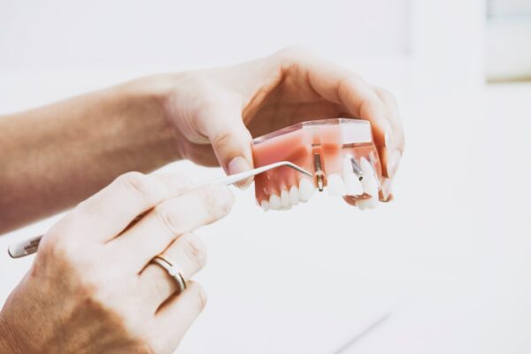 Top Tips for Healthy Smiles: Apple Valley Dental