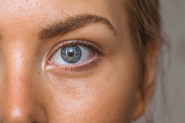 Understanding the Difference: Wart vs Skin Tag